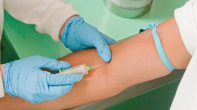 Venipuncture is a method in which a nurse or doctor uses a needle to draw blood from a vein, and is usually used for laboratory tests.
