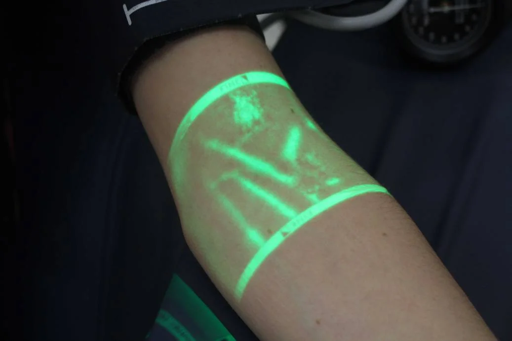With the Handheld Vein Finder: in hand, you can find a suitable vein to draw blood without vein detection. Vdetector devices are typically handheld and use infrared LED lights to provide a visual mapping of the veins.