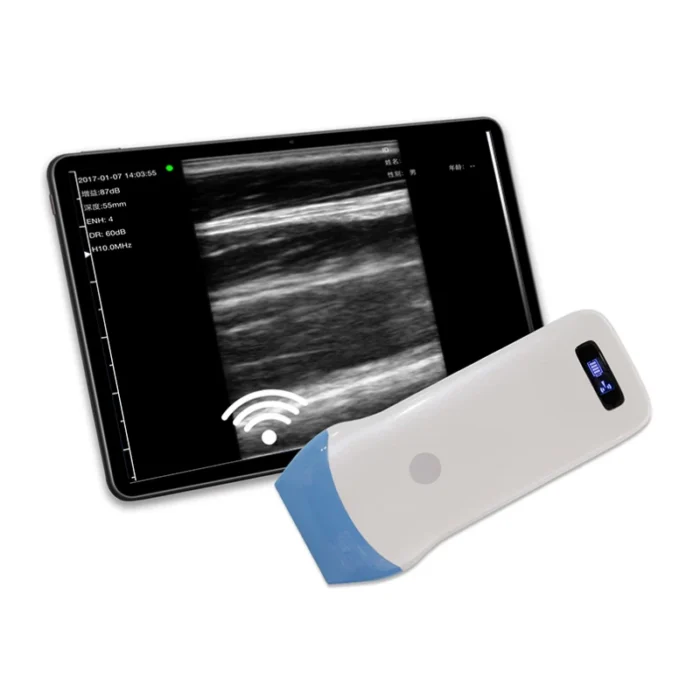 Linear Wireless Ultrasound Scanner: Vsono-L2 - Image 2