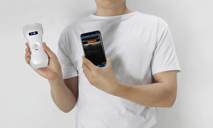 three-in-one-ultrasound-scanner-triple-headed.jpg