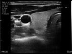 Dual-Head Wireless Ultrasound Scanner for Clinic and Hospital