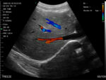 Portable Dual-Head Ultrasound Scanner with Color Doppler Technology