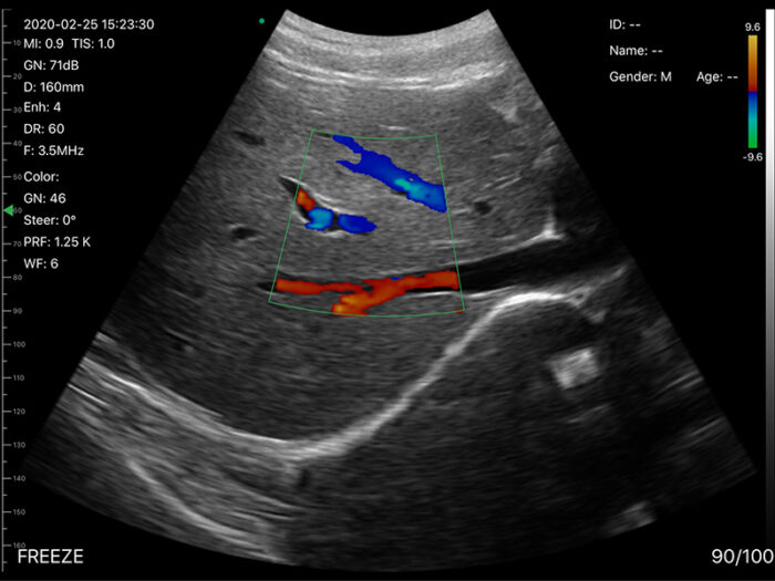 Portable Dual-Head Ultrasound Scanner with Color Doppler Technology