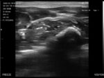 handheld-linear-wireless-ultrasound-scanner.jpg