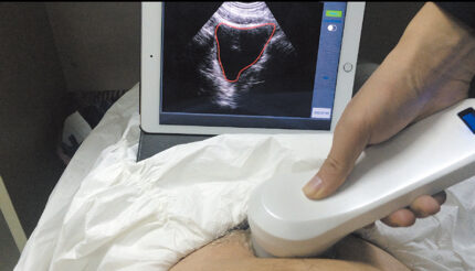 handheld-ultrasound-scanner-bladder-measurement.jpg