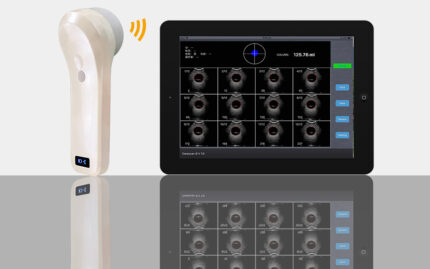 wireless-bladder-scanner-4d-medical-device.jpg