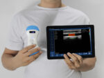 Triple-Head Ultrasound Scanner, Wireless Multi-Probe System, Cardiology Doppler Ultrasound, Portable Multi-Specialty Scanner, Vsono-CL1, Color Doppler for Pediatrics, Emergency Medicine Ultrasound, All-in-One Diagnostic Probe.