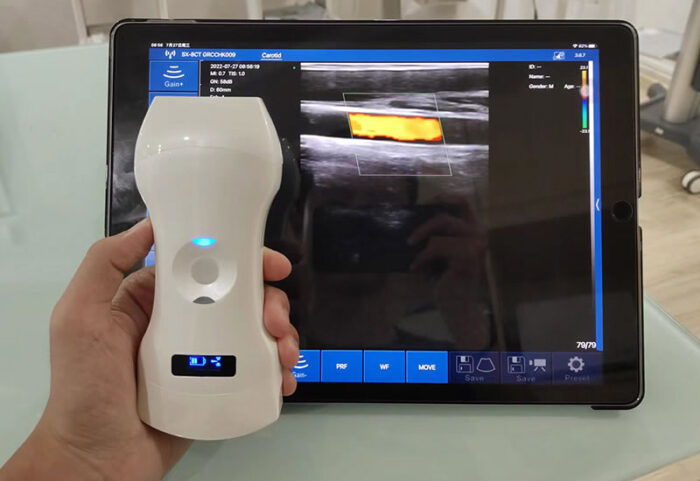 wireless-ultrasound-scanner-with-three-probes.jpg