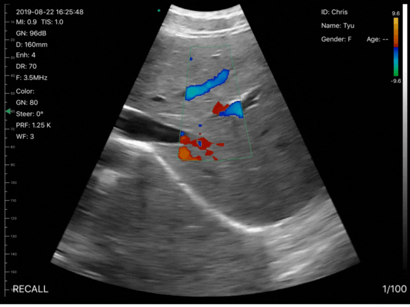 three-in-one-ultrasound-scanner-triple-headed.jpg