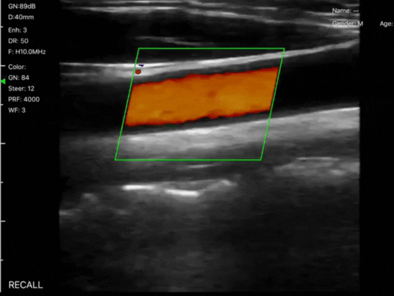 three-in-one-ultrasound-scanner-triple-headed.jpg