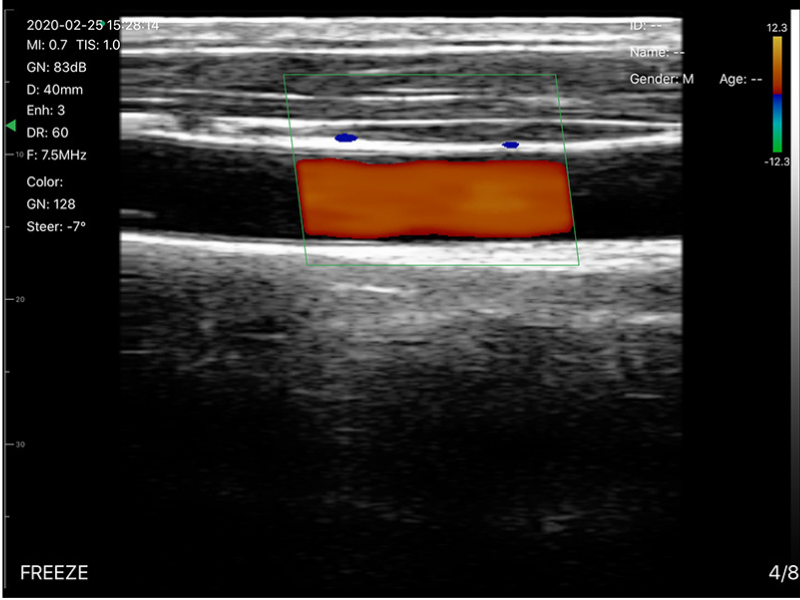 three-in-one-ultrasound-scanner-triple-headed.jpg