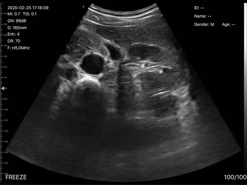 Triple Head Color Doppler Ultrasound Scanner: Vsono-CL4 is a wireless ultrasound probe that contains 3 heads in 1 device. The ultrasound scanner can be used for patient examination where a linear, convex, and/or phased array transducer is required for medical imaging. The Vsono-CL4 is compatible with Android and iOS smartphones and tablets. Thanks to its high number of elements (192), this wireless ultrasound scanner provides a high-quality image allowing for a fast and efficient diagnosis.