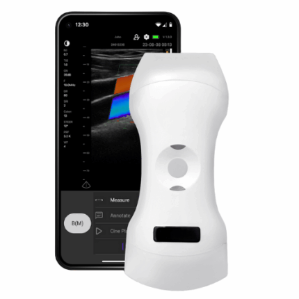 Triple Head Color Doppler Ultrasound Scanner: Vsono-CL4 is a wireless ultrasound probe that contains 3 heads in 1 device. The ultrasound scanner can be used for patient examination where a linear, convex, and/or phased array transducer is required for medical imaging. The Vsono-CL4 is compatible with Android and iOS smartphones and tablets. Thanks to its high number of elements (192), this wireless ultrasound scanner provides a high-quality image allowing for a fast and efficient diagnosis.