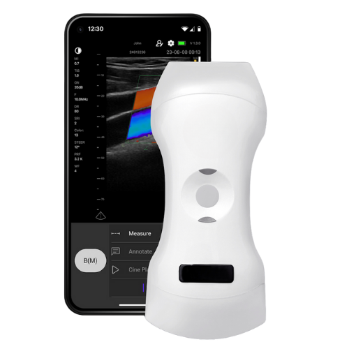 Triple Head Color Doppler Ultrasound Scanner: Vsono-CL4 is a wireless ultrasound probe that contains 3 heads in 1 device. The ultrasound scanner can be used for patient examination where a linear, convex, and/or phased array transducer is required for medical imaging. The Vsono-CL4 is compatible with Android and iOS smartphones and tablets. Thanks to its high number of elements (192), this wireless ultrasound scanner provides a high-quality image allowing for a fast and efficient diagnosis.