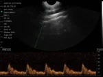 Wireless Transvaginal Ultrasound: Vsono-TVU2 - Image 6