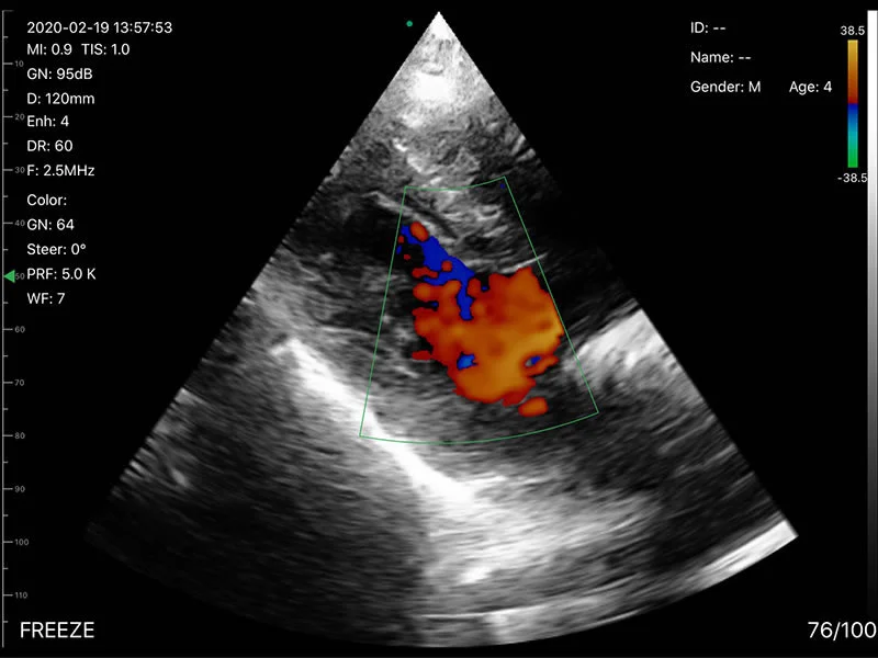 Triple Head Color Doppler Ultrasound Scanner: Vsono-CL4 is a wireless ultrasound probe that contains 3 heads in 1 device. The ultrasound scanner can be used for patient examination where a linear, convex, and/or phased array transducer is required for medical imaging. The Vsono-CL4 is compatible with Android and iOS smartphones and tablets. Thanks to its high number of elements (192), this wireless ultrasound scanner provides a high-quality image allowing for a fast and efficient diagnosis.