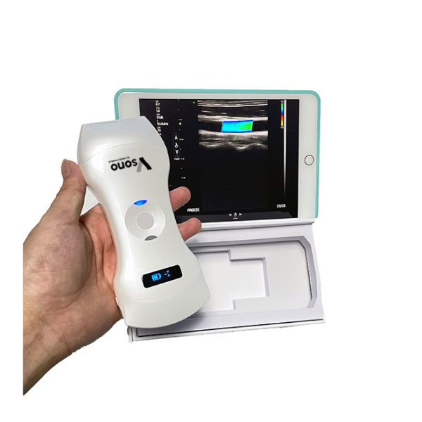 Triple Head Color Doppler Ultrasound Scanner: Vsono-CL4 is a wireless ultrasound probe that contains 3 heads in 1 device. The ultrasound scanner can be used for patient examination where a linear, convex, and/or a phased array transducer is required for medical imaging. The Vsono-CL4 is compatible with Android and iOS smartphones and tablets. Thanks to its high number of elements (192), this wireless ultrasound scanner provides a high-quality image allowing for a fast and efficient diagnosis.