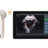 Wireless Bladder Ultrasound Scanner: Vsono-BL1 is a 4D bladder ultrasound scanner used to non-invasively visualize, monitor, and measure the urine volume in the bladder. It's used to determine the suitable urinary output and to prevent inappropriate insertion of the catheter into the bladder.  The Wireless Bladder Ultrasound Scanner: Vsono-BL1 is widely used in urology, rehabilitation, nursing homes, operation rooms, and home-based healthcare