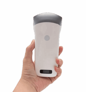 Vsono-C2: Wireless convex ultrasound scanner (3.5/5MHz) for iOS/Android. Real-time fetal monitoring, amniotic fluid checks & delivery room support. 3-hour battery. Ideal for OB/GYN, clinics & vets.