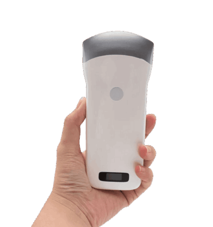 Vsono-C2: Wireless convex ultrasound scanner (3.5/5MHz) for iOS/Android. Real-time fetal monitoring, amniotic fluid checks & delivery room support. 3-hour battery. Ideal for OB/GYN, clinics & vets.