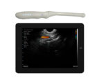 Wireless Transvaginal Ultrasound, Endovaginal Ultrasound Probe, Portable Pelvic Ultrasound, Smartphone Gynecological Scanner, Color Doppler TVUS, Vsono-TVU2, Handheld Transvaginal Probe, Fertility Ultrasound Device, OB-GYN Ultrasound Scanner, Wireless Cervical Imaging.