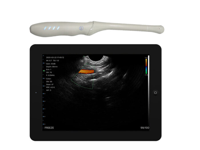 Wireless Transvaginal Ultrasound, Endovaginal Ultrasound Probe, Portable Pelvic Ultrasound, Smartphone Gynecological Scanner, Color Doppler TVUS, Vsono-TVU2, Handheld Transvaginal Probe, Fertility Ultrasound Device, OB-GYN Ultrasound Scanner, Wireless Cervical Imaging.