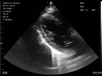 Compact and portable Vsono-CL4 wireless ultrasound scanner for medical imaging