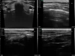 Doppler Super Width Linear Ultrasound: Vsono-SW1 - Image 3