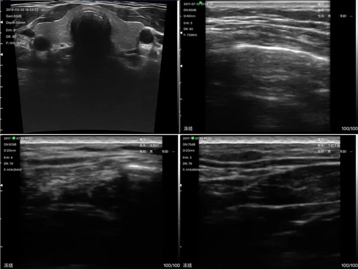Doppler Super Width Linear Ultrasound: Vsono-SW1 - Image 3