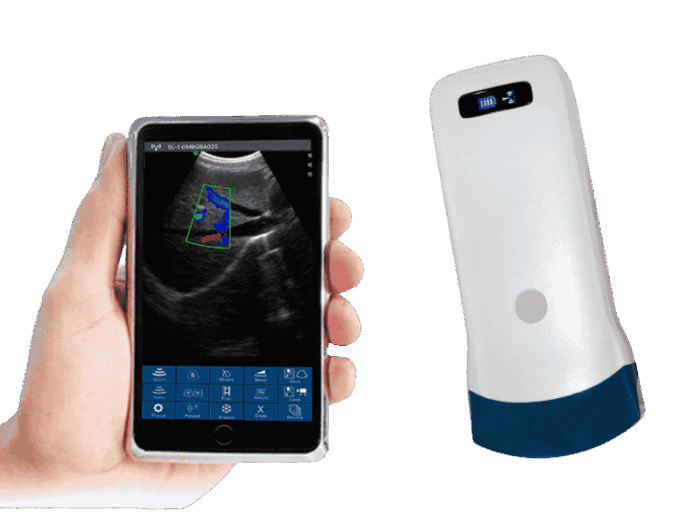 Color Doppler Convex Ultrasound: Vsono-C5 - Image 3