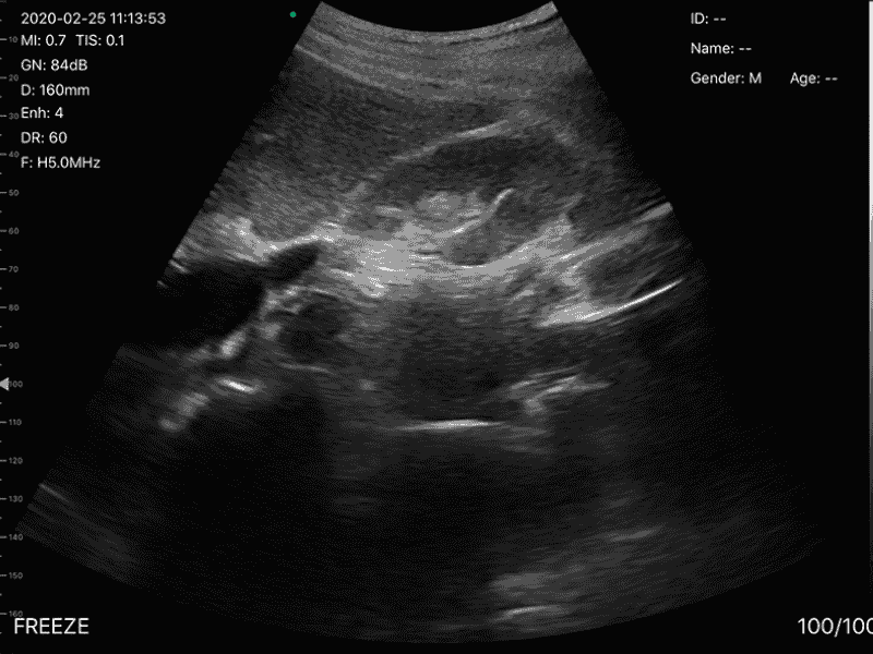 The Vsono-L1 is a high-performance wireless linear ultrasound scanner designed for vascular, musculoskeletal, nerve, and small-parts imaging. Its 128-element high-frequency probe delivers superior resolution and accuracy, with advanced Doppler modes for professional diagnostics.