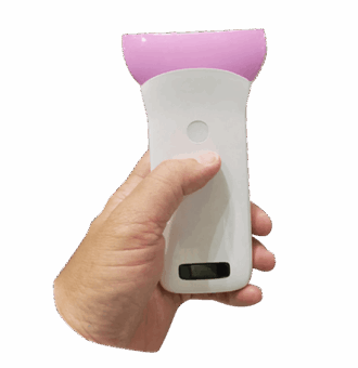 Super Width Linear Ultrasound, 256-Element Ultrasound Probe, Wireless Breast Ultrasound Scanner, Hip Dysplasia Ultrasound, Plastic Surgery Ultrasound, Doppler Lymphatic Mapping, Implant Integrity Scanner, Vsono-SW1, High-Resolution Musculoskeletal Ultrasound, Reconstructive Surgery Imaging.