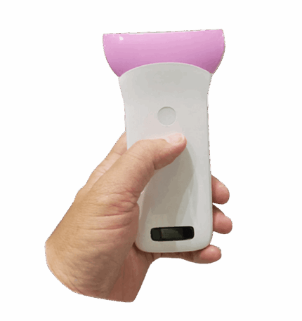 Super Width Linear Ultrasound, 256-Element Ultrasound Probe, Wireless Breast Ultrasound Scanner, Hip Dysplasia Ultrasound, Plastic Surgery Ultrasound, Doppler Lymphatic Mapping, Implant Integrity Scanner, Vsono-SW1, High-Resolution Musculoskeletal Ultrasound, Reconstructive Surgery Imaging.