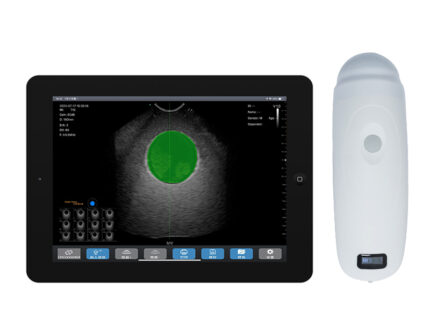 Wireless Bladder Scanner