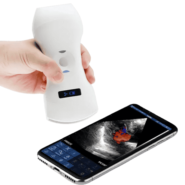 The Vsono-C1 is a portable convex ultrasound scanner designed to deliver clear, deep-tissue imaging wherever clinical decisions are made — in hospitals, clinics, or remote care settings. With a 128-element convex probe, this wireless scanner is optimised for abdominal organs, pregnancy checks, and soft tissue examinations, making it an ideal choice for professionals in general practice, obstetrics, musculoskeletal care, dermatology, and more.