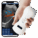 The Vsono-C1 is a portable convex ultrasound scanner designed to deliver clear, deep-tissue imaging wherever clinical decisions are made — in hospitals, clinics, or remote care settings. With a 128-element convex probe, this wireless scanner is optimised for abdominal organs, pregnancy checks, and soft tissue examinations, making it an ideal choice for professionals in general practice, obstetrics, musculoskeletal care, dermatology, and more.