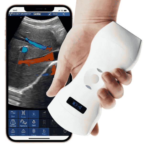 The Vsono-C1 is a portable convex ultrasound scanner designed to deliver clear, deep-tissue imaging wherever clinical decisions are made — in hospitals, clinics, or remote care settings. With a 128-element convex probe, this wireless scanner is optimised for abdominal organs, pregnancy checks, and soft tissue examinations, making it an ideal choice for professionals in general practice, obstetrics, musculoskeletal care, dermatology, and more.