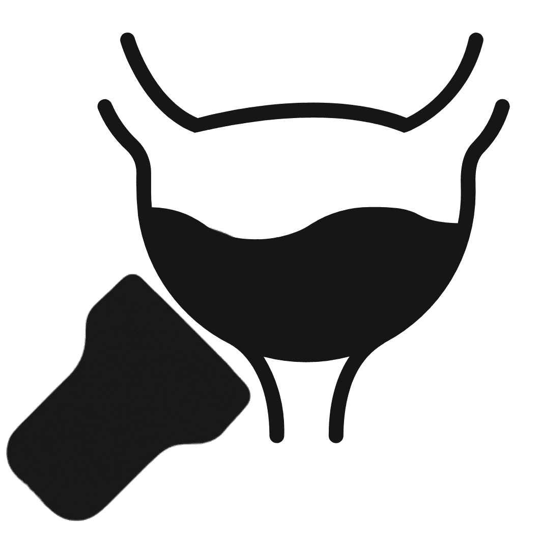 bladder ultrasound scanner