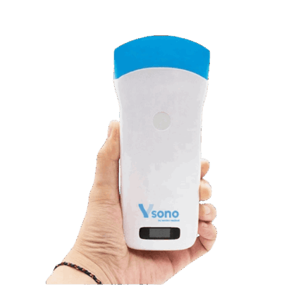 Transvaginal wireless ultrasound probe for OB/GYN use