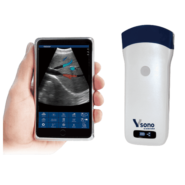 vSONO CONVEX ULTRASOUND PROBE