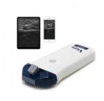 Mini-Linear Ultrasound Scanner