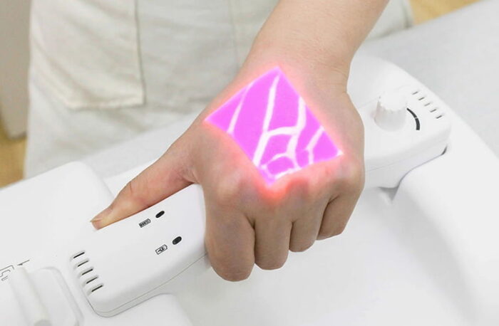 Desktop Medical Vein Finder: Vdetector-D2 - Image 2