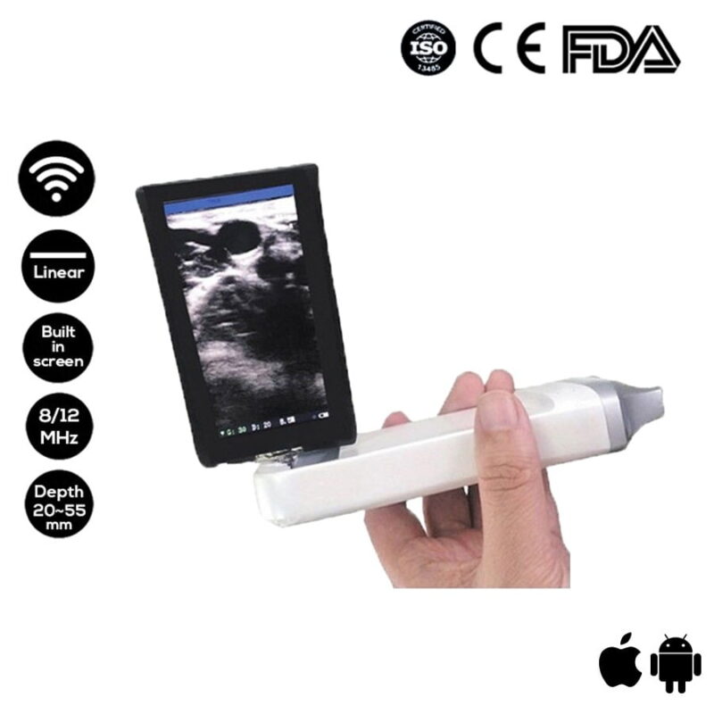 The Built-in Screen Mini-Linear Ultrasound Vsono-BML 1 is a wireless 8-12MHz ultrasound scanner. The Vsono-BML1 comes with a 3.5-inch rotatable screen. The min ultrasound offers wireless freedom