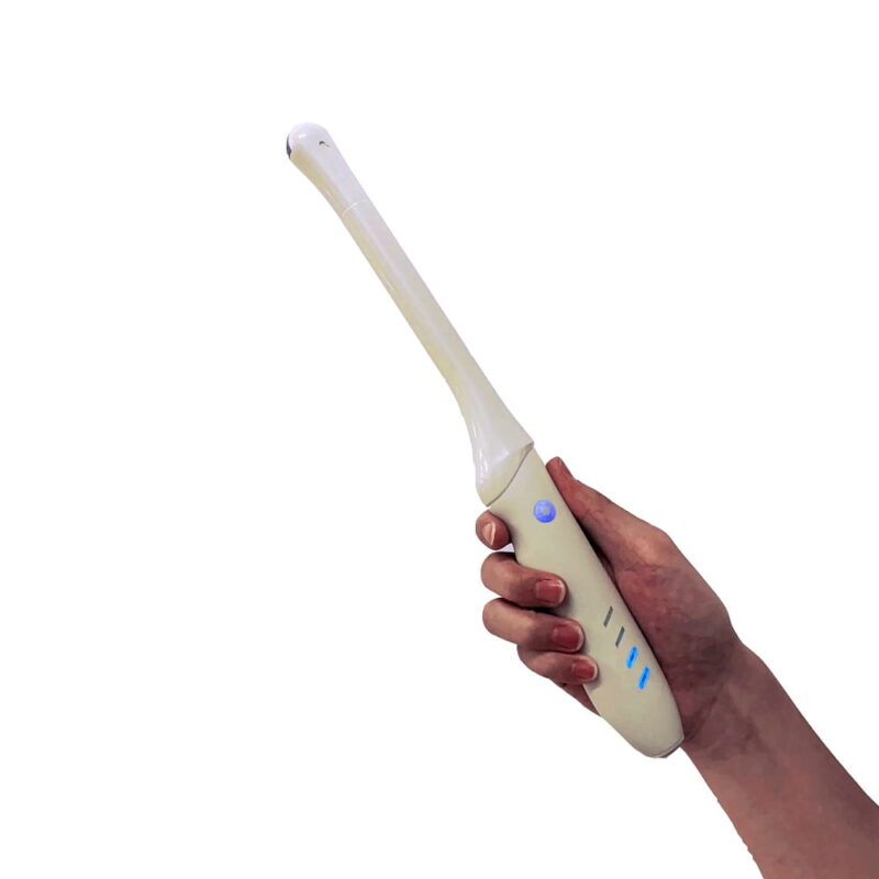 The Wireless Transvaginal Ultrasound