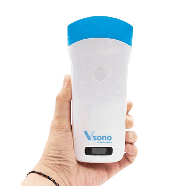 High-resolution ultrasound image displayed on tablet via VSONO probe