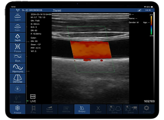 Our built-in WiFi works on the device’s own LAN, not external internet, so you can use your portable ultrasound anywhere—even in remote locations.