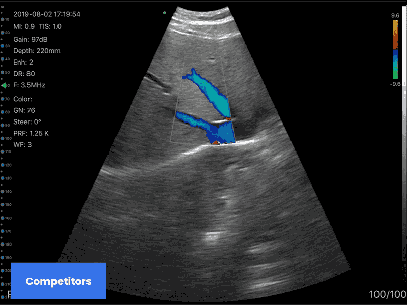 wireless-ultrasound-scanner-with-three-probes.jpg