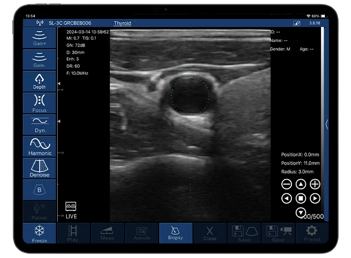 Freeze The Moment You Want Press the centered button of the scanner, pause anytime during your scanning process to choose the most ideal result of the body.
