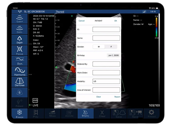 Save & Share Ultrasound With Observation Save image or video in the menu and download the file with your observation to your device. Share the result with other physicians and your patients to help them stay informed.