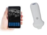 The VSONO-ML3 is a state-of-the-art, handheld linear ultrasound scanner engineered specifically for the nuances of aesthetic medicine and dermatology. By combining ultra-high frequency imaging (up to 22MHz) with a compact, wireless design, the VSONO-ML3 empowers practitioners to visualize facial anatomy with unprecedented clarity, ensuring safer injections and superior patient outcomes.